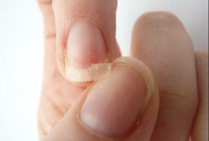 Cuidados de uñas para prevenir el quiebre y la fragilidad